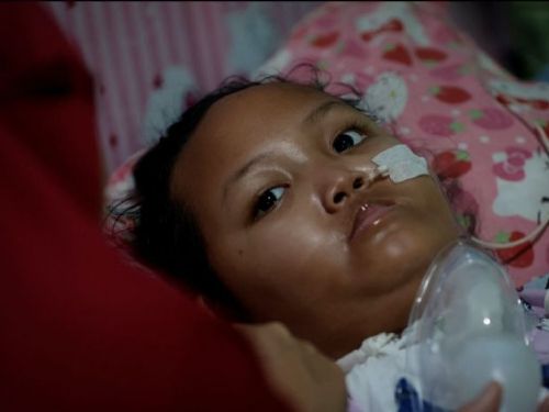 有毒咳藥水奪印尼200童命　倖存兒童內臟受損失行動力未來堪憂