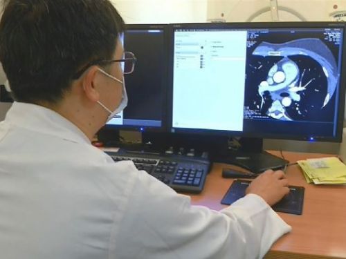 肺癌蔓延成新癌王，專家籲早篩檢提升存活率